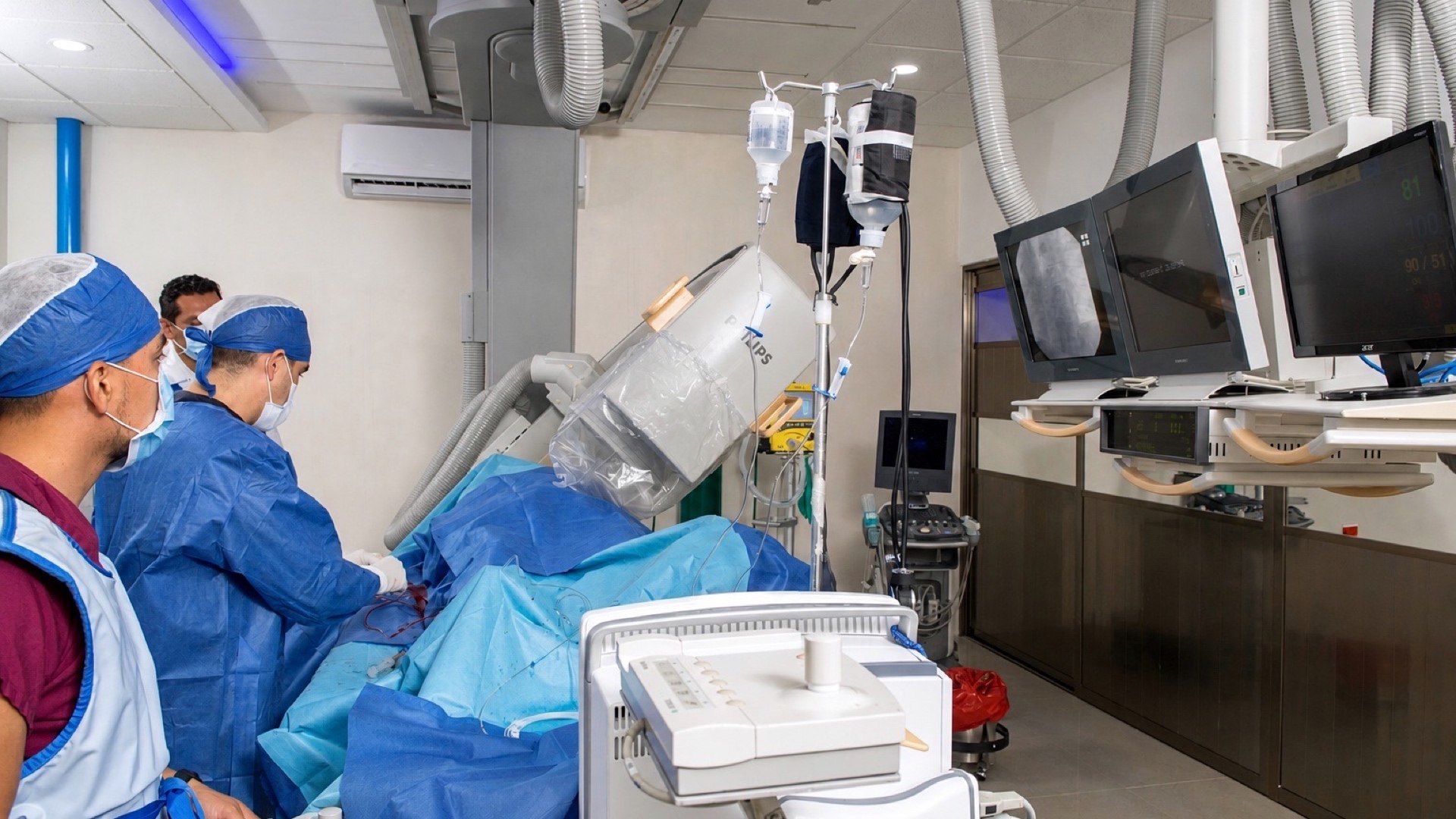 El equipo del hospital en la sala de hemodinamia, con el arco en C sobre la mesa y la torre de monitores al lado.