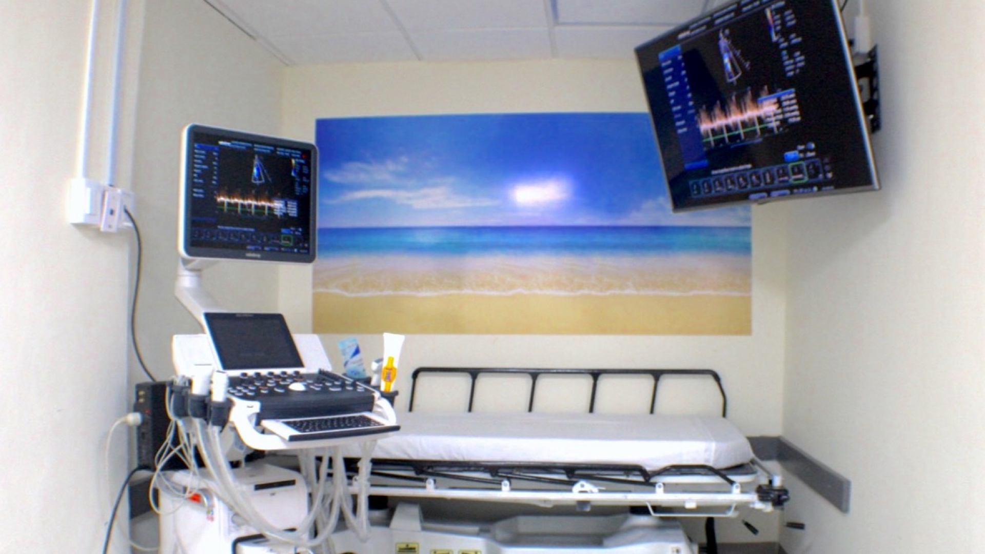 El equipo de ultrasonido junto a la camilla, con los monitores encendidos sobre la pared.